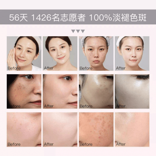 国妆特字的祛斑产品安全吗，人气口碑俱佳，闭眼入